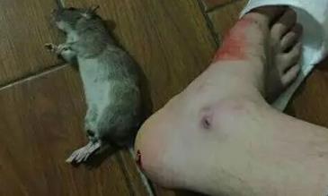 老鼠咬人吗会得病吗__老鼠会咬死人吗
