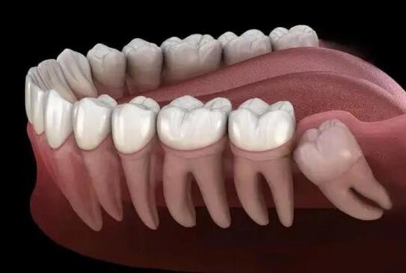 进化完全的人类不长智齿__人类长智齿是进化还是退化