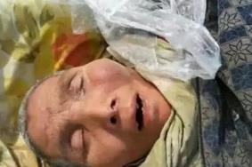 死了嘴张开_死者张开嘴_