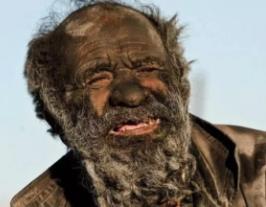 世界上最邋遢的人：60多年不洗澡还喝脏水（最邋遢的人）__世界上最邋遢的人：60多年不洗澡还喝脏水（最邋遢的人）