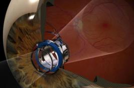 最小的望远镜__小的望远镜